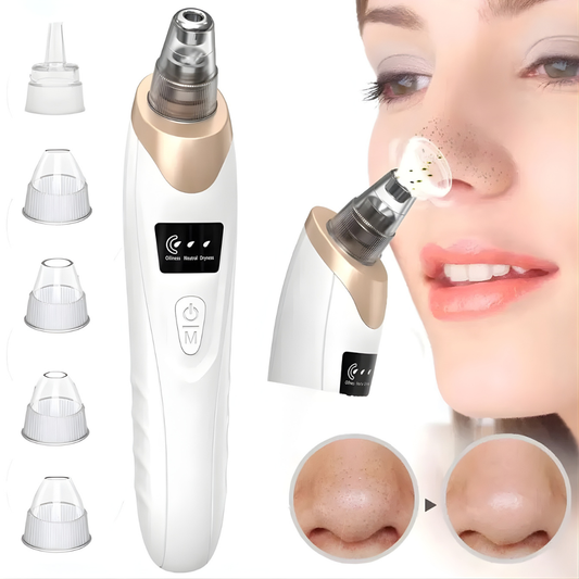 Electric Blackhead Remover – Pore Vacuum Suction Cleaner